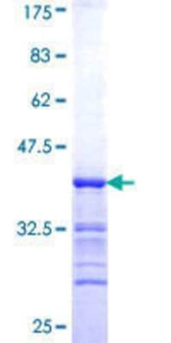 Novus Biologicals Recombinant Human PCYT1A GST (N-Term) Protein 25 &mu;g | Buy Online | Novus Biologicals&trade; | Fisher Scientific
