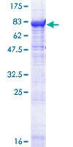 Novus Biologicals Recombinant Human PDE1A GST (N-Term) Protein 25 &mu;g | Buy Online | Novus Biologicals&trade; | Fisher Scientific