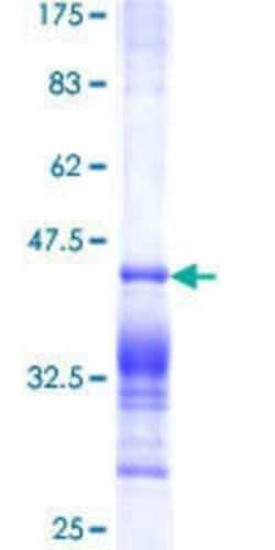 Novus Biologicals Recombinant Human PDE1A GST (N-Term) Protein 10 &mu;g | Buy Online | Novus Biologicals&trade; | Fisher Scientific