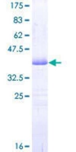 Novus Biologicals Recombinant Human PDE3A GST (N-Term) Protein 25 &mu;g | Buy Online | Novus Biologicals&trade; | Fisher Scientific