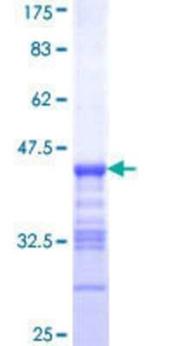 Novus Biologicals Recombinant Human PDE3B GST (N-Term) Protein 25 &mu;g | Buy Online | Novus Biologicals&trade; | Fisher Scientific
