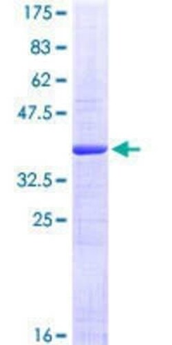 Novus Biologicals Recombinant Human PDE6C GST (N-Term) Protein 10 &mu;g | Buy Online | Novus Biologicals&trade; | Fisher Scientific
