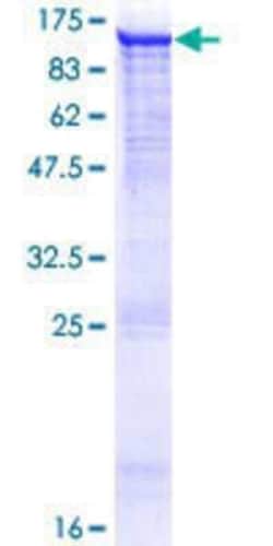 Novus Biologicals Recombinant Human PDE8A GST (N-Term) Protein 10 &mu;g | Buy Online | Novus Biologicals&trade; | Fisher Scientific
