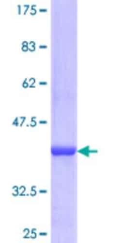 Novus Biologicals Recombinant Human PDE9A GST (N-Term) Protein 25 &mu;g | Buy Online | Novus Biologicals&trade; | Fisher Scientific