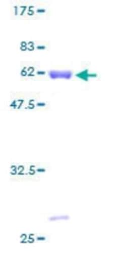 Novus Biologicals Recombinant Human Pyruvate Dehydrogenase E1 beta subunit GST (N-Term) Protein 25 &mu;g | Buy Online | Novus Biologicals&trade; | Fisher Scientific