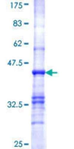 Novus Biologicals Recombinant Human Pyruvate Dehydrogenase E1 beta subunit GST (N-Term) Protein 10 &mu;g | Buy Online | Novus Biologicals&trade; | Fisher Scientific