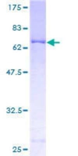 Novus Biologicals Recombinant Human PDK2 GST (N-Term) Protein 25 &mu;g | Buy Online | Novus Biologicals&trade; | Fisher Scientific