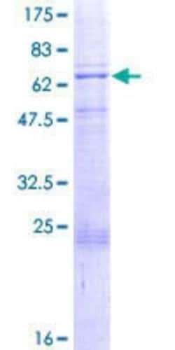 Novus Biologicals Recombinant Human PDK3 GST (N-Term) Protein 2 &mu;g | Buy Online | Novus Biologicals&trade; | Fisher Scientific