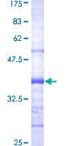 Novus Biologicals Recombinant Human PDK3 GST (N-Term) Protein 10 &mu;g | Buy Online | Novus Biologicals&trade; | Fisher Scientific