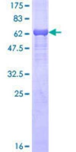 Novus Biologicals Recombinant Human PDK4 GST (N-Term) Protein 10 &mu;g | Buy Online | Novus Biologicals&trade; | Fisher Scientific