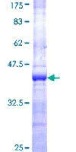 Novus Biologicals Recombinant Human ENPP-3/CD203c GST (N-Term) Protein 10 &mu;g | Buy Online | Novus Biologicals&trade; | Fisher Scientific