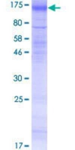 Novus Biologicals Recombinant Human SLC26A4 GST (N-Term) Protein 2 &mu;g | Buy Online | Novus Biologicals&trade; | Fisher Scientific