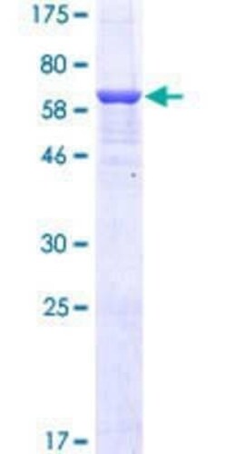 Novus Biologicals Recombinant Human SLC26A4 GST (N-Term) Protein 10 &mu;g | Buy Online | Novus Biologicals&trade; | Fisher Scientific