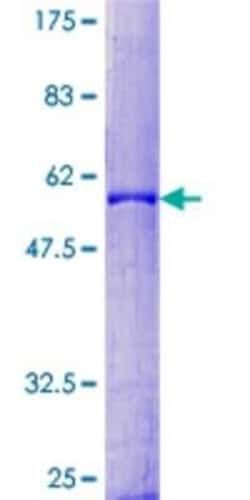 Novus Biologicals Recombinant Human Prodynorphin/PDYN GST (N-Term) Protein 2 &mu;g | Buy Online | Novus Biologicals&trade; | Fisher Scientific