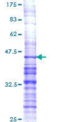 Novus Biologicals Recombinant Human Prodynorphin/PDYN GST (N-Term) Protein 10 &mu;g | Buy Online | Novus Biologicals&trade; | Fisher Scientific