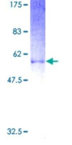 Novus Biologicals Recombinant Human Proenkephalin GST (N-Term) Protein 2 &mu;g | Buy Online | Novus Biologicals&trade; | Fisher Scientific