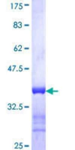 Novus Biologicals Recombinant Human PET112L GST (N-Term) Protein 10 &mu;g | Buy Online | Novus Biologicals&trade; | Fisher Scientific