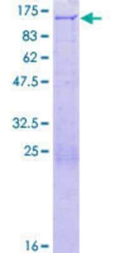 Novus Biologicals&trade;&nbsp;Recombinant Human PEX6 GST (N-Term) Protein