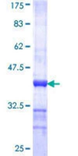 Novus Biologicals Recombinant Human PEX6 GST (N-Term) Protein 25 &mu;g | Buy Online | Novus Biologicals&trade; | Fisher Scientific