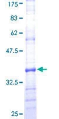 Novus Biologicals Recombinant Human PEX7 GST (N-Term) Protein 25 &mu;g:Proteínas