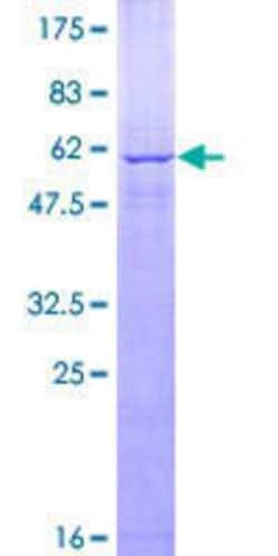 Novus Biologicals&trade;&nbsp;Recombinant Human PEX10 GST (N-Term) Protein