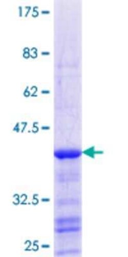 Novus Biologicals Recombinant Human PEX13 GST (N-Term) Protein 25 &mu;g | Buy Online | Novus Biologicals&trade; | Fisher Scientific