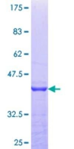 Novus Biologicals Recombinant Human PEX14 GST (N-Term) Protein 10 &mu;g | Buy Online | Novus Biologicals&trade; | Fisher Scientific