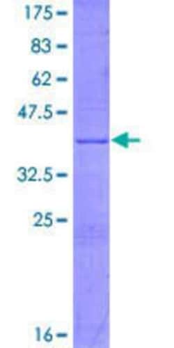 Novus Biologicals Recombinant Human PFKFB1 GST (N-Term) Protein 25 &mu;g | Buy Online | Novus Biologicals&trade; | Fisher Scientific