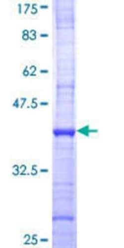 Novus Biologicals Recombinant Human PFKFB4 GST (N-Term) Protein 25 &mu;g | Buy Online | Novus Biologicals&trade; | Fisher Scientific