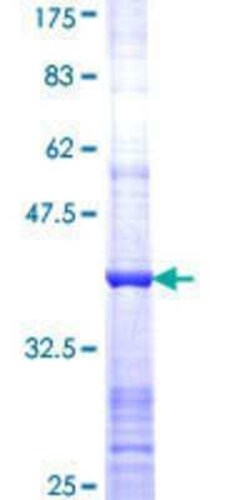 Novus Biologicals Recombinant Human PFKL GST (N-Term) Protein 10 &mu;g | Buy Online | Novus Biologicals&trade; | Fisher Scientific