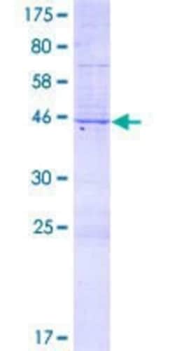 Novus Biologicals Recombinant Human Vitrin GST (N-Term) Protein 2 &mu;g | Buy Online | Novus Biologicals&trade; | Fisher Scientific