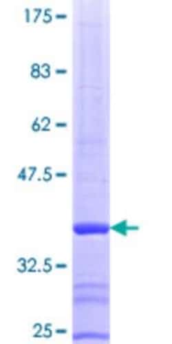 Novus Biologicals Recombinant Human PFKP GST (N-Term) Protein 25 &mu;g | Buy Online | Novus Biologicals&trade; | Fisher Scientific