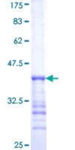 Novus Biologicals Recombinant Human PFTK1 GST (N-Term) Protein 25 &mu;g | Buy Online | Novus Biologicals&trade; | Fisher Scientific