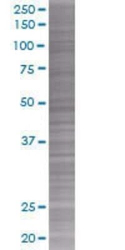Novus Biologicals PLGF 293T Cell Transient Overexpression Lysate 0.1 mL | Buy Online | Novus Biologicals&trade; | Fisher Scientific