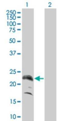 Novus Biologicals PLGF 293T Cell Transient Overexpression Lysate 0.1 mL | Buy Online | Novus Biologicals&trade; | Fisher Scientific