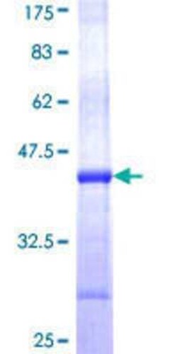 Novus Biologicals Recombinant Human PGGT1B GST (N-Term) Protein 10 &mu;g | Buy Online | Novus Biologicals&trade; | Fisher Scientific