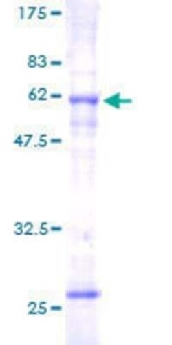 Novus Biologicals Recombinant Human SLC25A3 GST (N-Term) Protein 25 &mu;g | Buy Online | Novus Biologicals&trade; | Fisher Scientific