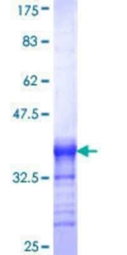 Novus Biologicals Recombinant Human PHF2 GST (N-Term) Protein 25 &mu;g | Buy Online | Novus Biologicals&trade; | Fisher Scientific