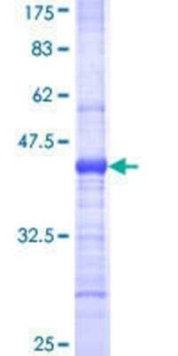 Novus Biologicals Recombinant Human PHKA1 GST (N-Term) Protein 25 &mu;g | Buy Online | Novus Biologicals&trade; | Fisher Scientific