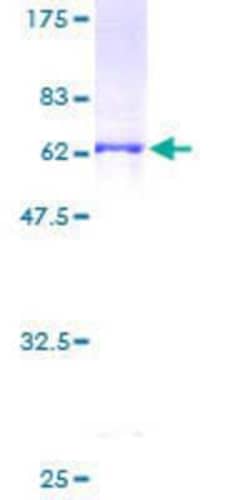 Novus Biologicals&trade;&nbsp;Recombinant Human PHYH GST (N-Term) Protein