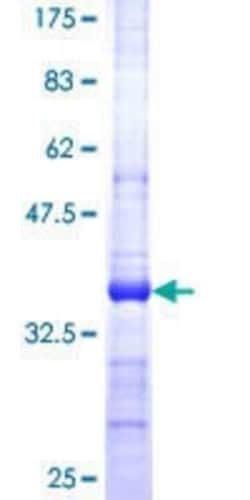 Novus Biologicals Recombinant Human SerpinB9 GST (N-Term) Protein 25 &mu;g | Buy Online | Novus Biologicals&trade; | Fisher Scientific
