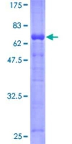 Novus Biologicals Recombinant Human Serpin I2 GST (N-Term) Protein 10 &mu;g | Buy Online | Novus Biologicals&trade; | Fisher Scientific