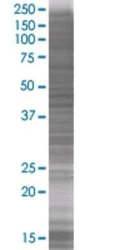 Novus Biologicals Serpin I2 293T Cell Transient Overexpression Lysate 0.1 mL | Buy Online | Novus Biologicals&trade; | Fisher Scientific