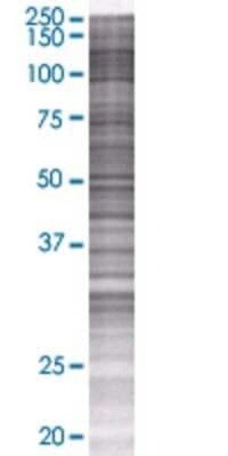 Novus Biologicals Serpin I2 293T Cell Transient Overexpression Lysate 0.1 mL | Buy Online | Novus Biologicals&trade; | Fisher Scientific