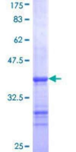 Novus Biologicals Recombinant Human PIGA GST (N-Term) Protein 25 &mu;g | Buy Online | Novus Biologicals&trade; | Fisher Scientific