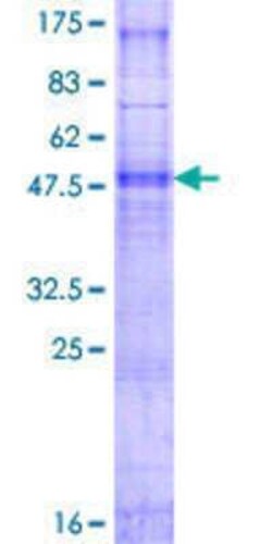 Novus Biologicals Recombinant Human PIGC GST (N-Term) Protein 2 &mu;g | Buy Online | Novus Biologicals&trade; | Fisher Scientific