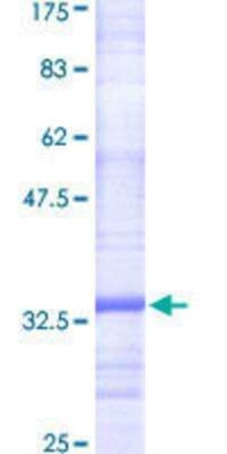 Novus Biologicals Recombinant Human PIGC GST (N-Term) Protein 25 &mu;g | Buy Online | Novus Biologicals&trade; | Fisher Scientific