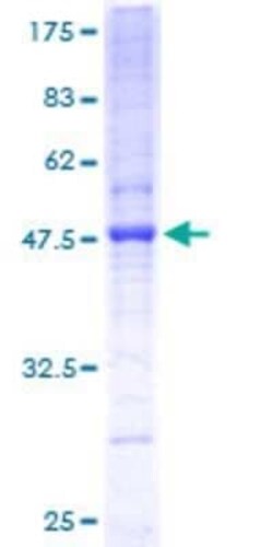 Novus Biologicals Recombinant Human PIGH GST (N-Term) Protein 2 &mu;g | Buy Online | Novus Biologicals&trade; | Fisher Scientific