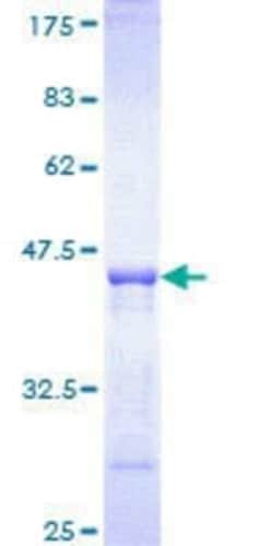 Novus Biologicals Recombinant Human PI 3-Kinase C2 beta GST (N-Term) Protein 10 &mu;g | Buy Online | Novus Biologicals&trade; | Fisher Scientific