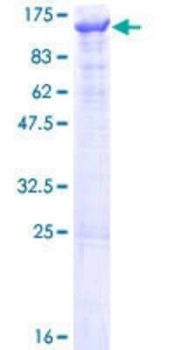 Novus Biologicals Recombinant Human VPS34 GST (N-Term) Protein 10 &mu;g | Buy Online | Novus Biologicals&trade; | Fisher Scientific